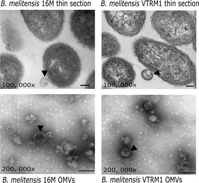 Outer Membrane Vesicles From Brucella melitensis Modulate Immune Response and Induce Cytoskeleton Rearrangement in Peripheral Blood Mononuclear Cells